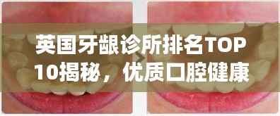 英国牙龈诊所排名TOP10揭秘,优质口腔健康服务一览